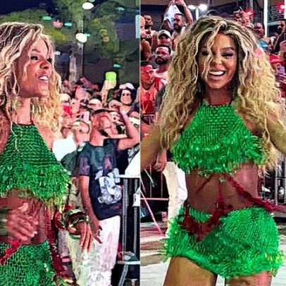 Brunna Gonçalves comenta pós-operatório após desfile da Grande Rio