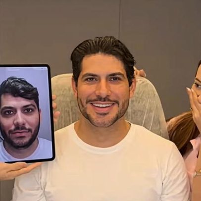 Mirela Janis mostra harmonização facial do marido Yugnir e brinca