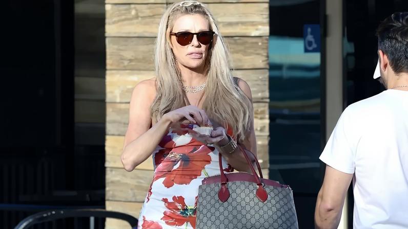 Brandi Glanville is “thrilled” to “finally” have a diagnosis for her facial disfigurement after a two-year search for answers. Javiles/Bruce / BACKGRID