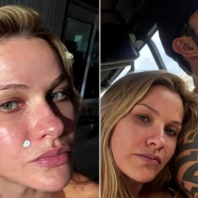 Andressa Suita comenta pele ruim e a realidade de quem tenta engravidar
