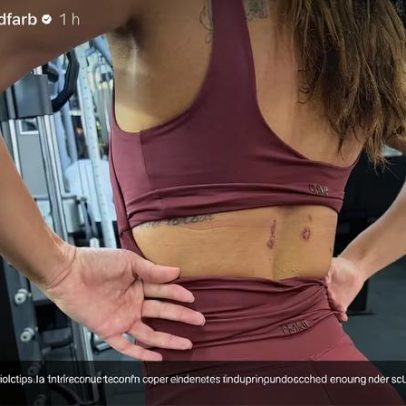 Mariana Goldfarb exibe marcas do Carnaval e mostra resultado do treino de bumbum