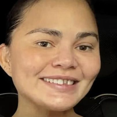 Dente de Chrissy Teigen cai durante jogo de Natal