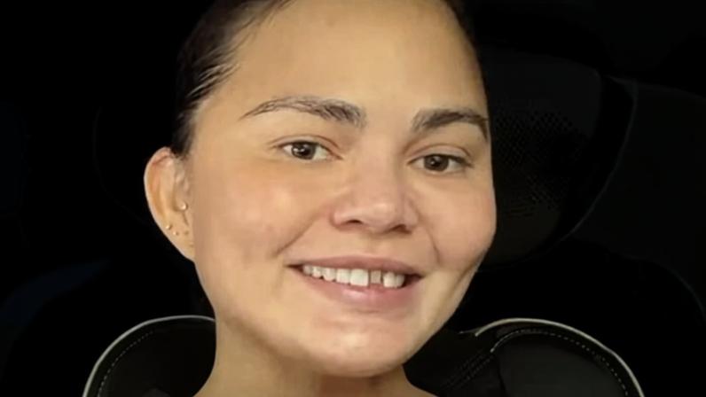 Chrissy Teigen’s tooth — well, the veneer that covered her shaved-down tooth — fell out in a holiday game “gone wrong.”