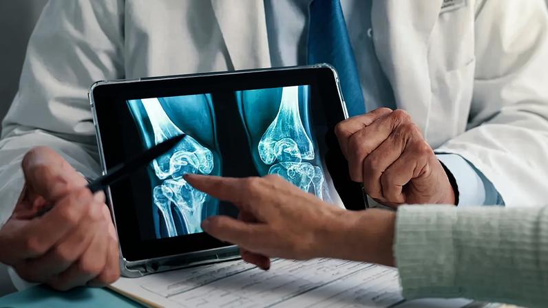 Fotografia das mãos de um médico segurando um tablet mostrando um raio-x de um joelho.