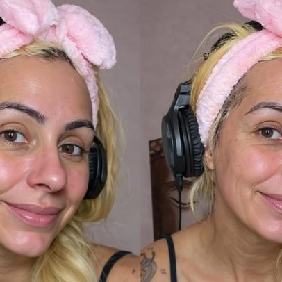 Médica aponta riscos do uso de sangue menstrual na pele após reação alérgica
