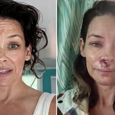 Evangeline Lilly revela plano de tratamento após lesão cerebral