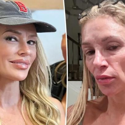 Brandi Glanville mostra novo visual após grave deformação facial