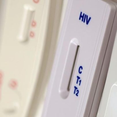 Saúde amplia testagem de HIV em comunidades indígenas e diagnostica ISTs