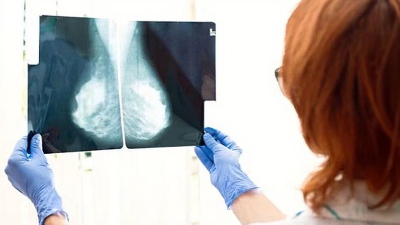 A doctor looks at an x-ray.