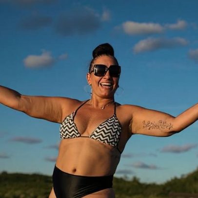 Solange Couto, 69, emagrece 40 kg em 12 meses após várias cirurgias plásticas