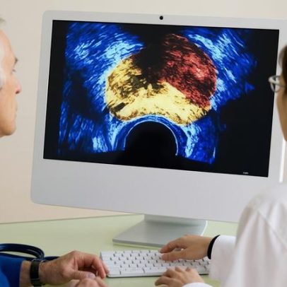 Câncer de próstata é o mais diagnosticado no Reino Unido, aponta estudo