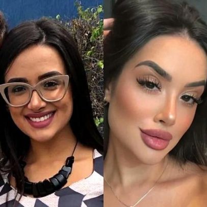 Jordana do BBB 26 fica irreconhecível após gastar R$ 40 mil em procedimentos