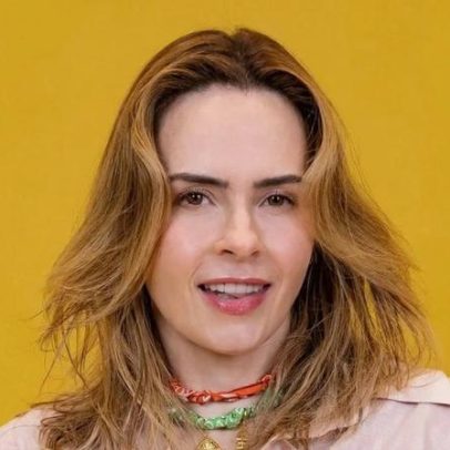 Ana Paula Renault usa laser, botox e radiofrequência em protocolo para glow discreto