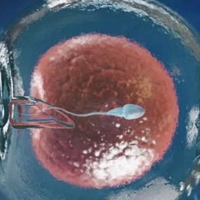 Descoberta em defeitos de óvulos pode amenizar oscilações da FIV