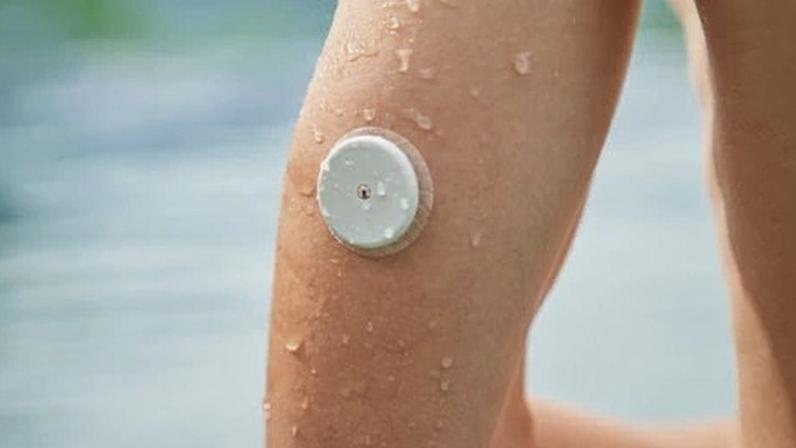 Minorias étnicas na Inglaterra têm menos acesso à tecnologia para diabetes