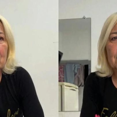 Juju do Pix aparece após 2ª cirurgia no rosto; antes e depois impressionam