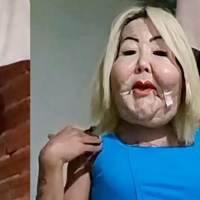 Juju do Pix mostra rosto quase dois meses após cirurgia e responde a críticas