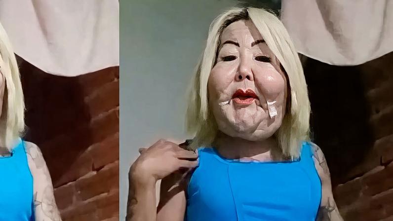 Juju do Pix revela mudança no rosto quase 2 meses após cirurgia e debocha de críticas: 'Um corpo é um corpo'