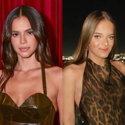 Rinoplastia: 20 famosas mostram mudanças no nariz e no rosto