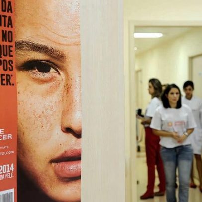 Casos de câncer de pele disparam de 4 mil para 72 mil em dez anos