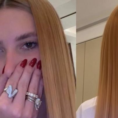 Virgínia exibe cabelo manchado após procedimento de R$ 4 mil em Dubai