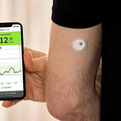 Dispositivos vestíveis ampliam monitoramento contínuo da saúde