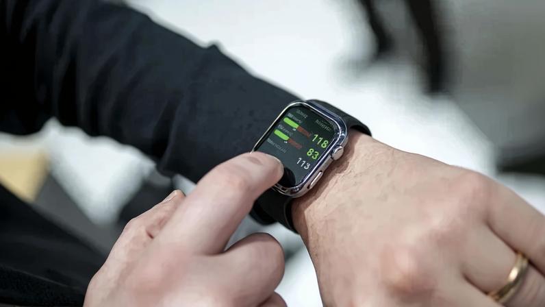 BARCELONA, SPAIN - MARCH 03: A man displays a smart watch at MWC 2025, in Barcelona, Spain on March 03, 2025. (Photo by Lorena Sopena/Anadolu via Getty Images) (Anadolu/Getty Images)