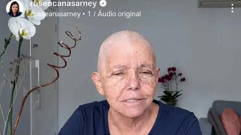 Roseana Sarney expõe batalha contra câncer. (Foto: Reprodução / Intsagram @ roseanasarney)