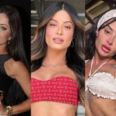 Aline Campos, ex-Riscado, transforma rosto com harmonização e corpo com plásticas
