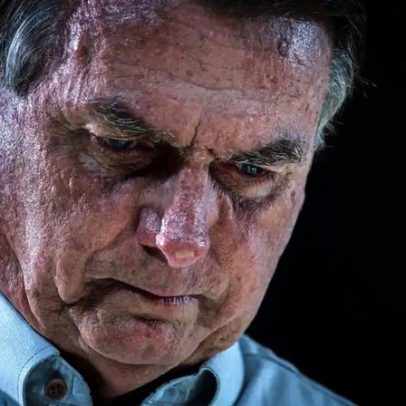 Comorbidades de Bolsonaro preocupam e sala na PF é inadequada, diz cirurgião