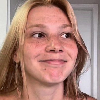 Atriz e modelo de 32 anos sofre AVC e relata susto intenso