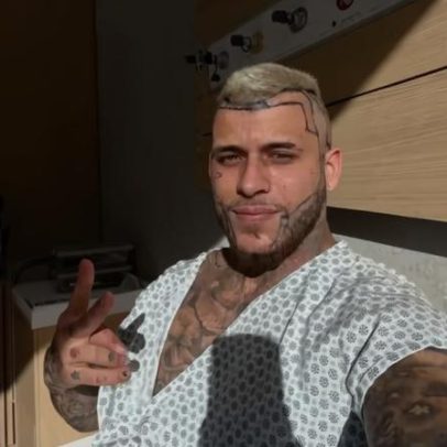 MC Pedrinho faz implante capilar; rosto fica inchado e repercute