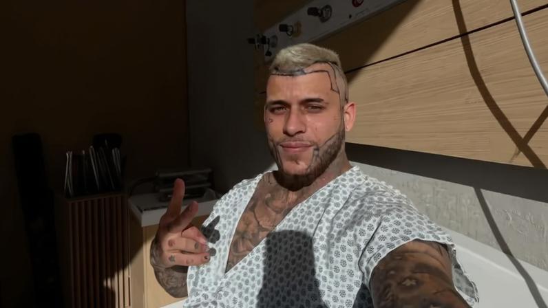 MC Pedrinho faz implante capilar