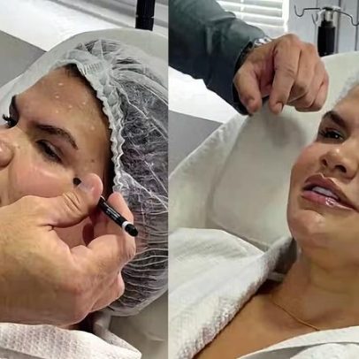 Após perder 80 kg, Thais Carla faz botox e celebra amor próprio diário