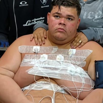 Gordão da XJ fará cirurgia para remover pedra na vesícula após perder peso