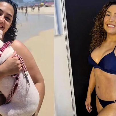 Camila Moura retira 3 litros de gordura e mostra antes e depois