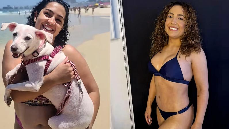 Camila Moura retira 3 litros de gordura