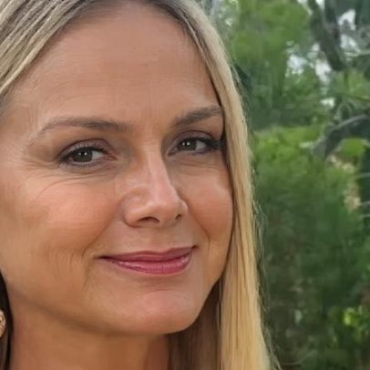 Famosas acima de 40 trocam ou removem implantes de silicone, veja fotos