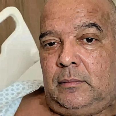 Fábio Bêça desabafa após 40 dias internado com infecção grave