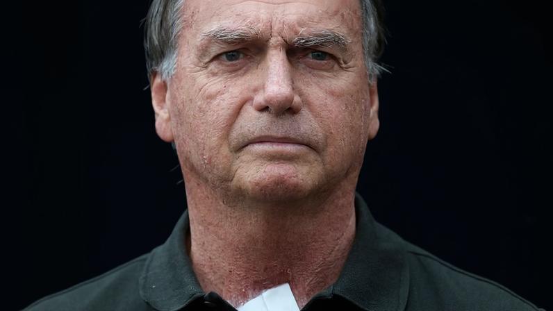 Jair Bolsonaro deixa hospital após retirar manchas na pele em hospital em Brasília