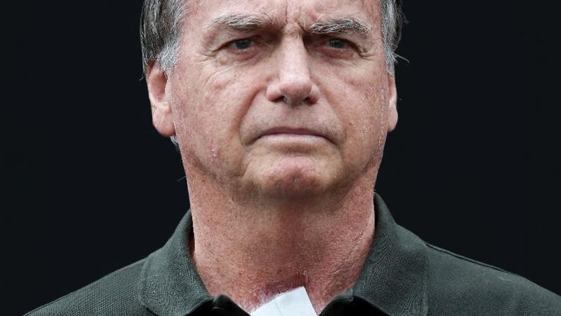 Defesa de Jair Bolsonaro (PL) entrou com pedido de prisão domiciliar após procedimentos médicos