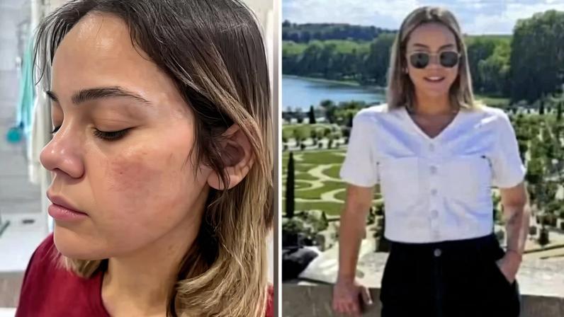 Brasileira vítima de tentativa de estupro em Paris é ouvida pela primeira vez por Justiça francesa