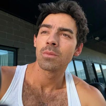 Joe Jonas diz que patches para abaixo dos olhos de US$14 são os melhores