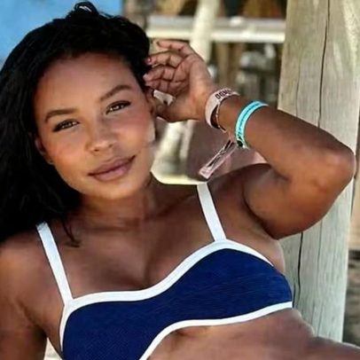 Luane Dias compartilha antes e depois em redes sociais