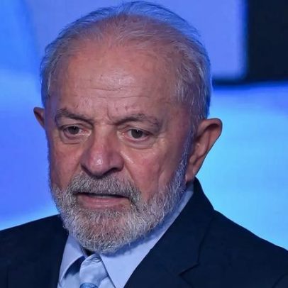 Lula opera catarata sem intercorrências e retorna ao trabalho na segunda