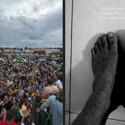 Nikolas segue rumo a Brasília com pés machucados e apoio