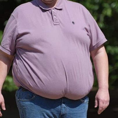 Brasileiro está mais obeso e com pior saúde aponta estudo