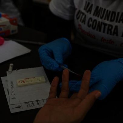 Cobertura de testagem para HIV cresce 47% em comunidades indígenas