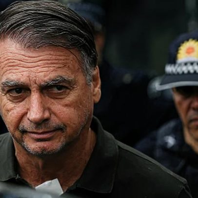 Exames de Bolsonaro evidenciam densificação de partes moles na cabeça