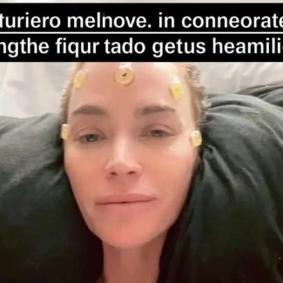 Teddi Mellencamp enfrenta luta contra o câncer após comentários do pai